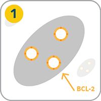 How Venclexta Works - Step 1