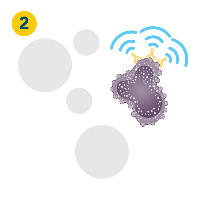 Diagram showing obinutuzumab attaching to the CD20 protein on the surface of a cancer cell and stopping its growth - Step 2